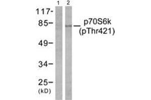 Western blot analysis of extracts from NIH-3T3 cells treated with EGF 200ng/ml 30', using p70 S6 Kinase (Phospho-Thr421) Antibody. (RPS6KB1 Antikörper  (pThr444))