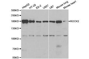 Western blot analysis of extracts of various cell lines, using ROCK2 antibody. (ROCK2 Antikörper  (AA 1109-1388))