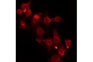 Immunofluorescence (fixed cells) (IF/ICC) image for anti-Solute Carrier Family 39 (Zinc Transporter), Member 2 (Slc39a2) (N-Term) antibody (ABIN6266107)
