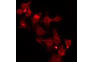 ABIN6272466 staining Hela by IF/ICC. (ZIP2 Antikörper  (N-Term))