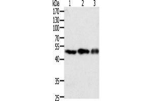 Western Blotting (WB) image for anti-Coagulation Factor VII (F7) antibody (ABIN2428811)