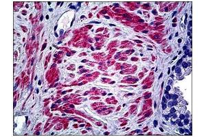 Immunohistochemistry (Paraffin-embedded Sections) (IHC (p)) image for anti-Collagen, Type V, alpha 2 (COL5A2) (C-Term), (Chain alpha 2) antibody (ABIN784132)