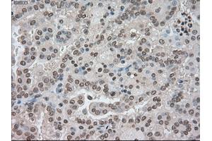 Image no. 2 for anti-Budding Uninhibited By Benzimidazoles 1 Homolog beta (Yeast) (BUB1B) antibody (ABIN1497000) (BUB1B Antikörper)