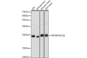Western blot analysis of extracts of various cell lines, using HSPB8/HSP22 antibody (ABIN3016166, ABIN3016167, ABIN3016168 and ABIN6219596) at 1:3000 dilution. (HSPB8 Antikörper  (AA 1-196))