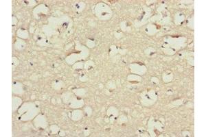 Immunohistochemistry of paraffin-embedded human brain tissue using ABIN7145604 at dilution of 1:100 (BLOC1S2 Antikörper  (AA 44-142))