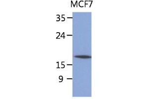 The lysate of MCF7 (40ug) were resolved by SDS-PAGE, transferred to PVDF membrane and probed with anti-human SSR4 antibody (1:1000). (SSR4 Antikörper)