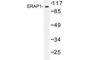 Image no. 2 for anti-Endoplasmic Reticulum Aminopeptidase 1 (ERAP1) antibody (ABIN272255)