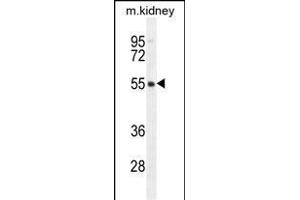 FBXO47 Antibody (N-term) (ABIN655283 and ABIN2844874) western blot analysis in mouse kidney tissue lysates (35 μg/lane). (FBXO47 Antikörper  (N-Term))