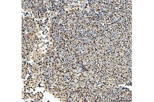 IHC analysis of SFPQ using anti-SFPQ antibody (ABIN7603089). (SFPQ Antikörper  (Middle Region))