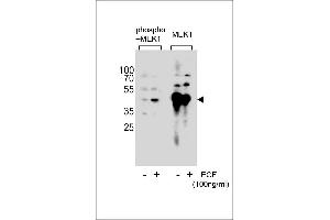 Western blot analysis of extracts from A431 cell,untreated or treated with EGF,100 ng/mL,using Phospho-MEK1-p(left) or MEK1-p Antibody (right). (MEK1 Antikörper  (pSer222))