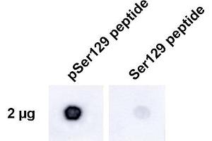 Dot Blot analysis using Rabbit Anti-Alpha Synuclein pSer129 Monoclonal Antibody, Clone J18 (ABIN6932864). (SNCA Antikörper  (pSer129) (Atto 594))