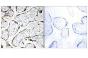 Immunohistochemistry analysis of paraffin-embedded human placenta tissue using EFEMP2 antibody. (FBLN4 Antikörper)
