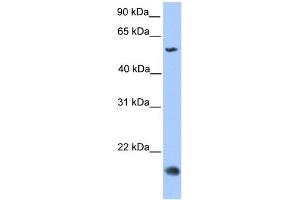 WB Suggested Anti-CMTM8 Antibody Titration: 0.