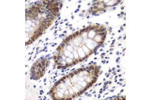 Immunohistochemistry of paraffin-embedded human colon using MSH6 antibody. (MSH6 Antikörper)