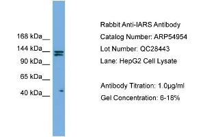 WB Suggested Anti-IARS  Antibody Titration: 0. (IARS Antikörper  (Middle Region))