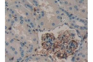 Detection of GAL1 in Human Kidney Tissue using Polyclonal Antibody to Galectin 1 (GAL1)