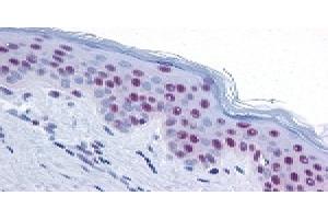 Image no. 3 for anti-MRE11 Meiotic Recombination 11 Homolog A (S. Cerevisiae) (MRE11A) antibody (ABIN363310)