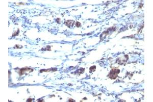 Formalin-fixed, paraffin-embedded human Stomach tissue stained with CD195 Mouse Monoclonal Antibody (12D1). (CCR5 Antikörper)