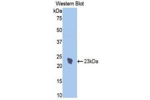 Western Blotting (WB) image for anti-Interleukin 1 Receptor, Type I (IL1R1) (AA 386-553) antibody (ABIN3209483) (IL1R1 Antikörper  (AA 386-553))