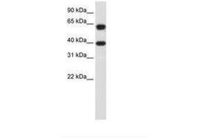 Image no. 3 for anti-Nuclear RNA Export Factor 3 (NXF3) (AA 435-484) antibody (ABIN203198) (NXF3 Antikörper  (AA 435-484))