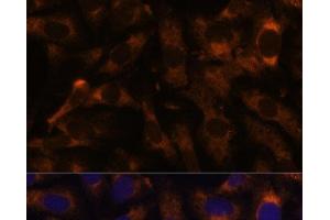 Immunofluorescence analysis of U-2 OS cells using SUCLG2 Polyclonal Antibody at dilution of 1:100 (40x lens). (SUCLG2 Antikörper)