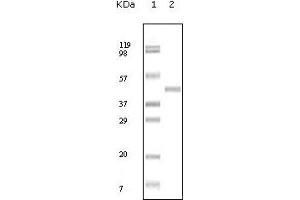 Western blot analysis using ABL2 mouse mAb against truncated ABL2 recombinant protein. (ABL2 Antikörper)