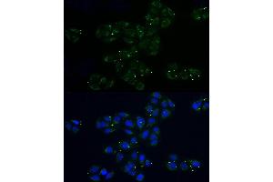 Immunofluorescence analysis of U2OS cells using MRPL32 Rabbit pAb (ABIN6131123, ABIN6144012, ABIN6144013 and ABIN6214117) at dilution of 1:100 (40x lens).