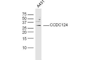 Human A431 cells probed with CCDC124 Polyclonal Antibody, unconjugated  at 1:300 overnight at 4°C followed by a conjugated secondary antibody at 1:10000 for 90 minutes at 37°C. (CCDC124 Antikörper  (AA 145-223))