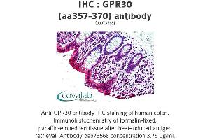 Image no. 1 for anti-G Protein-Coupled Estrogen Receptor 1 (GPER) (AA 357-370) antibody (ABIN1735055) (GPER Antikörper  (AA 357-370))