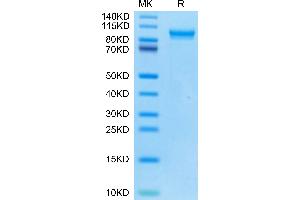 SDS-PAGE (SDS) image for Matrix Metallopeptidase 9 (Gelatinase B, 92kDa Gelatinase, 92kDa Type IV Collagenase) (MMP9) (AA 20-730) protein (His tag) (ABIN7275274)