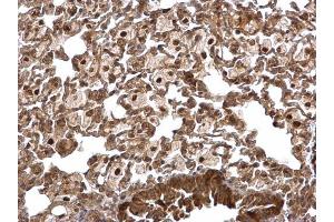 Immunohistochemistry (IHC) image for anti-Protein Phosphatase 1, Catalytic Subunit, beta Isoform (PPP1CB) (Center) antibody (ABIN2856078)