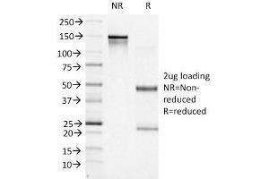 SDS-PAGE Analysis Purified BCL-6 Mouse Monoclonal Antibody (BCL6/1527).