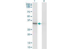 Western Blot analysis of PDXK expression in transfected 293T cell line by PDXK monoclonal antibody (M03), clone 4G6. (PDXK Antikörper  (AA 1-312))