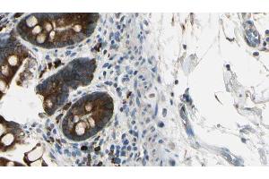 ABIN6267449 at 1/100 staining Mouse intestine tissue by IHC-P. (CXCR2 Antikörper  (pSer347))