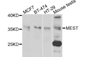 Western blot analysis of extracts of various cell lines, using MEST antibody. (MEST Antikörper)