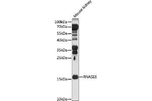 Western blot analysis of extracts of Mouse kidney, using RN antibody (ABIN7269987) at 1:1000 dilution. (RNASE6 Antikörper  (AA 1-150))