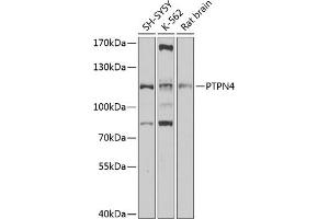 Western blot analysis of extracts of various cell lines, using PTPN4 antibody (ABIN6130551, ABIN6146450, ABIN6146451 and ABIN6220479) at 1:1000 dilution. (PTPN4 Antikörper  (AA 1-240))