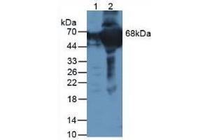 Figure. (F12 Antikörper  (AA 400-615))
