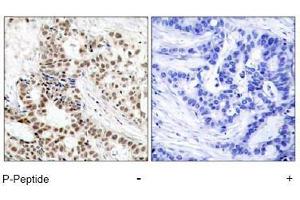 Image no. 1 for anti-Breast Cancer 1 (BRCA1) (pSer1423) antibody (ABIN196994) (BRCA1 Antikörper  (pSer1423))