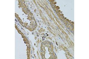Immunohistochemistry of paraffin-embedded human prostate using MYLIP antibody. (MYLIP Antikörper)