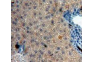 Used in DAB staining on fromalin fixed paraffin-embedded Liver tissue (IGFBP4 Antikörper  (AA 22-254))