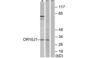 Western blot analysis of extracts from Jurkat cells and 293 cells, using OR10J1 antibody. (OR10J1 Antikörper  (C-Term))