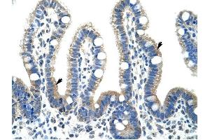 Fibrillarin antibody was used for immunohistochemistry at a concentration of 4-8 ug/ml to stain Epithelial cells of intestinal villus (arrows) in Human Intestine.