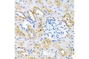 Immunohistochemistry of paraffin-embedded mouse kidney using MOK antibody. (MOK Antikörper)