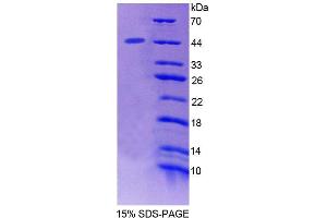 SDS-PAGE analysis of Mouse STAM2 Protein.
