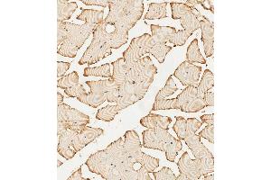 (ABIN392786 and ABIN2842224) staining PFKFB4 in human skeletal muscle tissue sections by Immunohistochemistry (IHC-P - paraformaldehyde-fixed, paraffin-embedded sections). (PFKFB4 Antikörper  (AA 266-296))