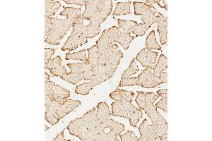 (ABIN392786 and ABIN2842224) staining PFKFB4 in human skeletal muscle tissue sections by Immunohistochemistry (IHC-P - paraformaldehyde-fixed, paraffin-embedded sections). (PFKFB4 Antikörper  (AA 266-296))