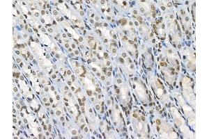 ABIN6255315 and ABIN6267100 at 1/100 staining Rat stomach tissue by IHC-P. (ARNTL Antikörper  (pSer42))
