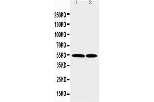 Anti-CCR3 antibody, Western blotting Lane 1: K562 Cell Lysate Lane 2: RAJI Cell Lysate (CCR3 Antikörper  (N-Term))