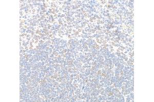 Immunohistochemistry (IHC) image for anti-Nucleoprotein TPR (TPR) (C-Term) antibody (ABIN7448922) (TPR Antikörper  (C-Term))